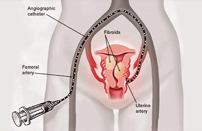 Interventions in obstetrics and Gynaecology 02